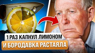 5 советов: как избавиться от бородавок и папиллом за 1 день @prozdorove