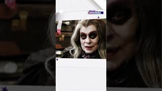 Leonardo faz piada com olho roxo após acidente em pescaria #HojeEmDia #Shorts