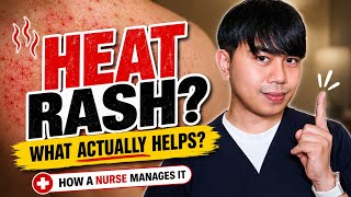 HEAT RASH? | How a Nurse Manages It + Evidence-Based Interventions