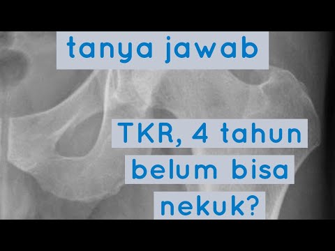 Video: 12 Tanya Jawab Tentang Bedah Penggantian Lutut Umum
