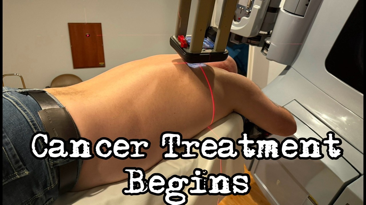 A Little About My Cancer