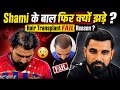 Mohammed Shami Hair Transplant FAIL? लाखों रुपये खर्च, फिर भी नहीं रुका Hair Fall ? Reason Explained