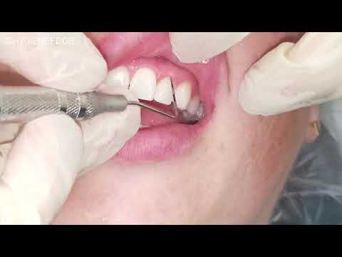 شرح أعماق التحقيق للمرضى