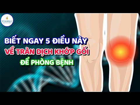 Video: 3 cách chẩn đoán đau đầu gối