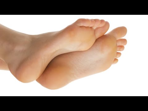 Видео: 3 начина да се отървете от мазолите по краката