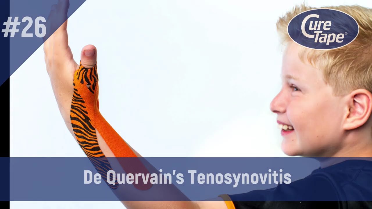 Vendaje para Tenosinovitis de De Quervain 