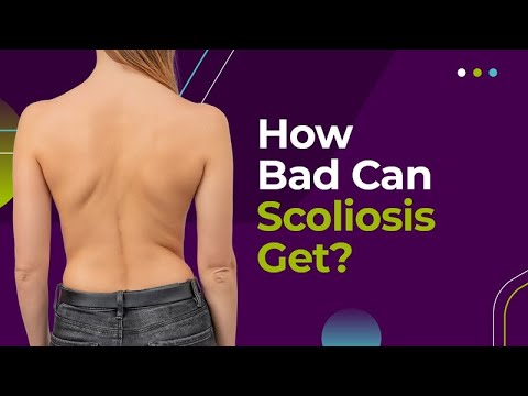 How Bad Can