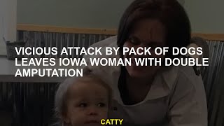 Vicious attack by dogs' package leaves a double amputation Iowa woman