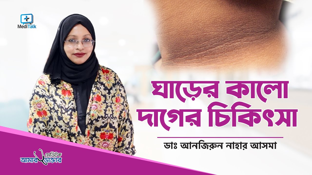 ঘাড়ের কালো দাগ দূর করার উপায়