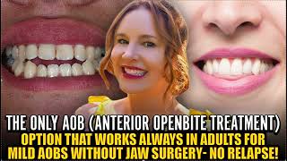 The Only Anterior Openbite Treatment that is PREDICTABLE in the Absence of Myo Issues