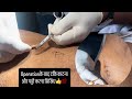 ऑपरेशन के बाद टाँके काटना और पट्टी करना सिखिए👍💯/#nurses #dressing #stitching #bscnursing #doctor