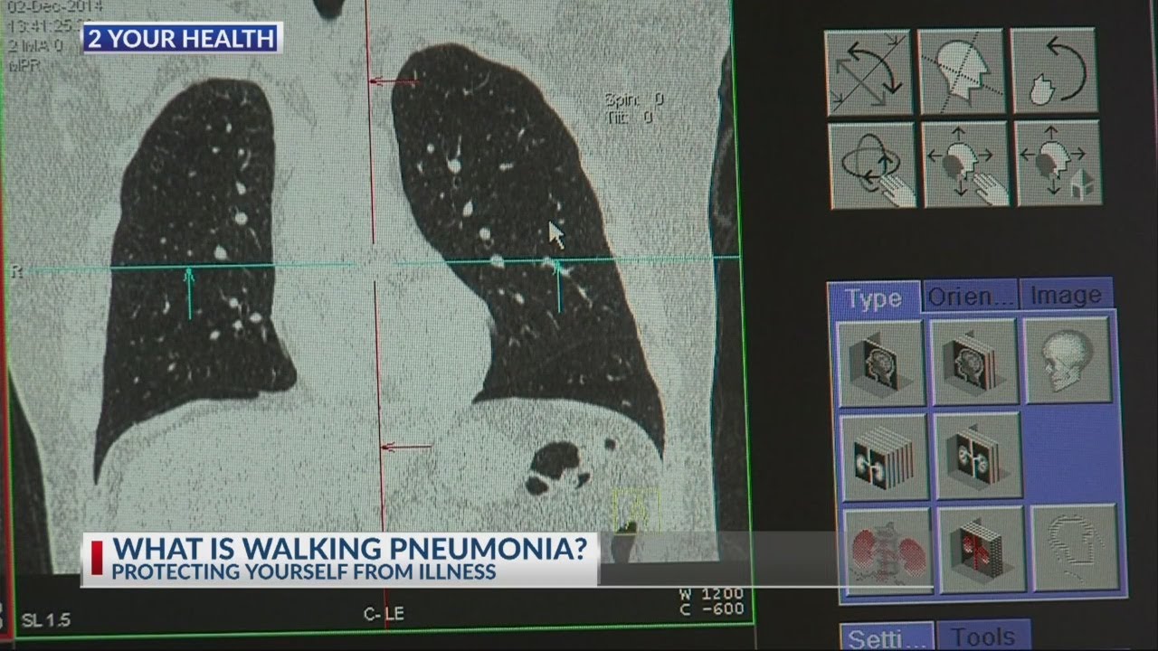 2 Your Health What is Walking Pneumonia YouTube