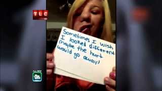Girl With Half a Face Fights Back -- The Doctors