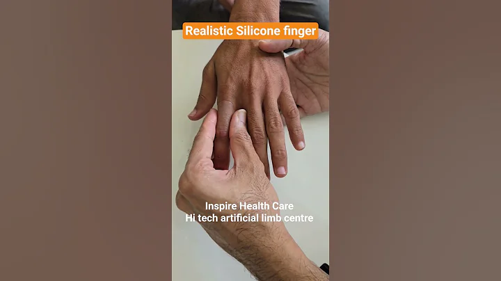 ✨ Realistic Silicone Artificial Finger ✨Inspire Health Care- Hi tech artificial limb centre