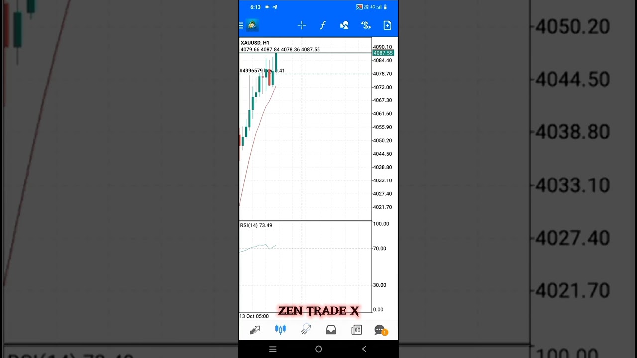 Real Forex Account Management | No Hype Pure Skill | Zen Trade X 