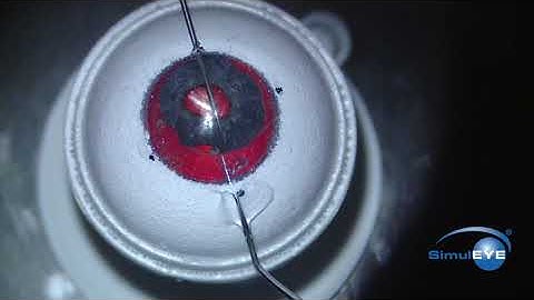 SimulEYE Iris Prosthesis IOL, CTR