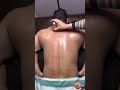 What is Fire Cupping Therapy? 🔥 | Complete Guide &amp; Benefit