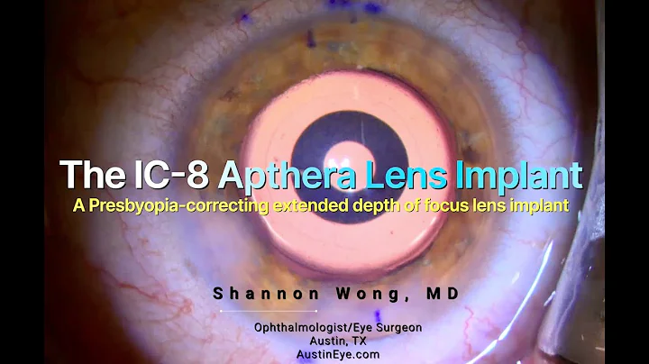 The IC-8 Apthera presbyopia-correcting extended depth of focus lens implant. Under-the-microscope.