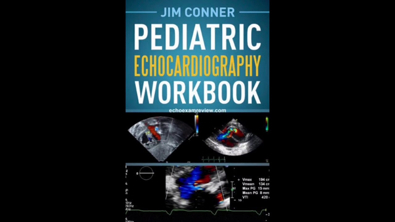Pediatric Echocardiography Workbook - YouTube