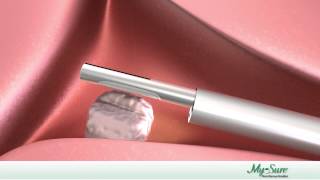 MyoSure Procedure Animation