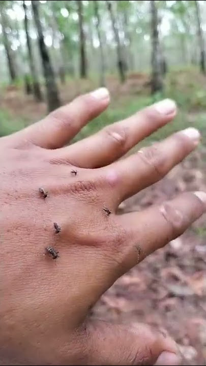 gigitan nyamuk #shorts #viral
