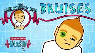 Science for kids  Bruises | Experiments for kids | Operation Ouch