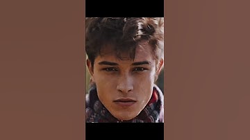 Asymmetry vs Symmetry #shorts #model #looksmaxxing #fyp #trending #tiktok