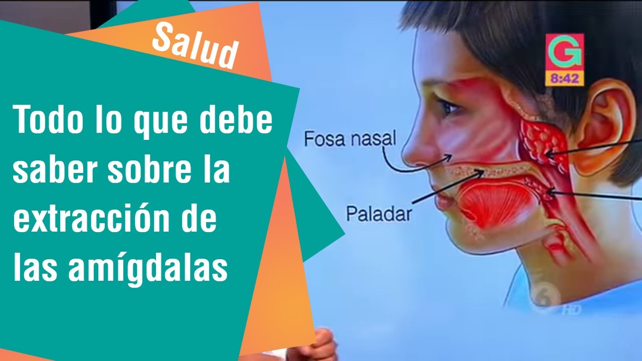 adenoides signos y sintomas de diabetes adenoides signos y sintomas de diabetes