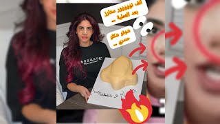 نور ستارز بعد عملية التجميل الانف? ?? شاهد قبل الحدف  Noorstars???