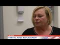 Doc Talk | The benefits of partial knee replacement
