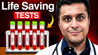 These 5 Heart Tests Can Save Your Life - Doctors Testing Guide