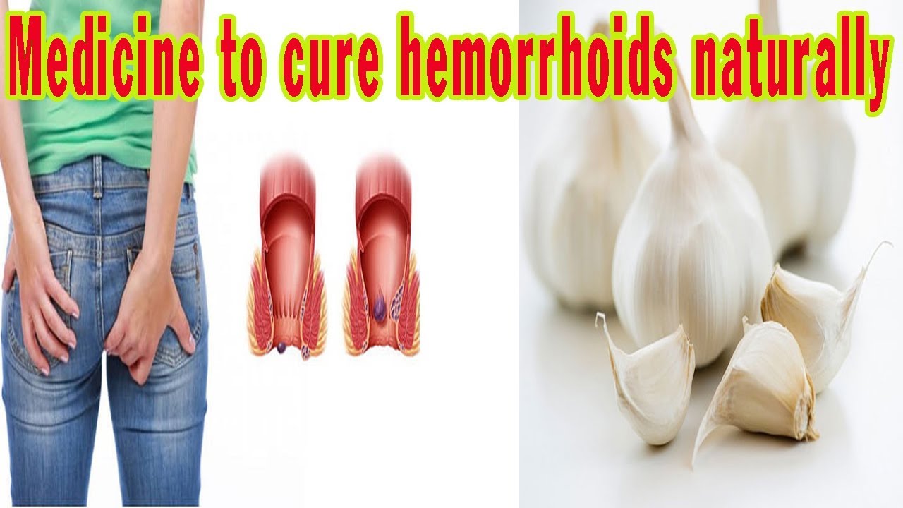 Medicine To Cure Hemorrhoids Naturally Activebeat Youtube