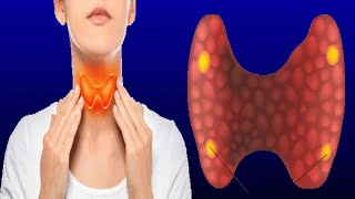 Parathyroid Gland Removal: Types And Preperation