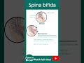 Spina bifida | 1min devbio