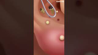 Asmr perawatan telinga #asmrrelaxing #asmr #follow #perawatan