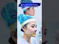 Màn “Lột Xác” Sau Nâng Mũi Khiến Chồng Không Rời Mắt #short #nangmui #mui