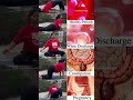 pcod yoga exercises for belly fat #shortsfeed #shorts #pcod #pcos #fibroids #whitedischarge