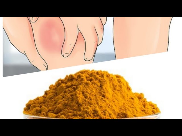 TURMERIC - Prevent blood clots after an injury - மஞ்சள் நன்மைகள் - Blood Clotting & Swelling Remedy | Food Tamil - Samayal & Vlogs