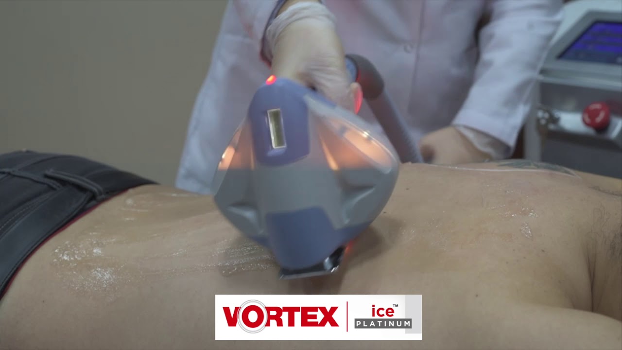 VORTEX ICE PLATINUM - YouTube