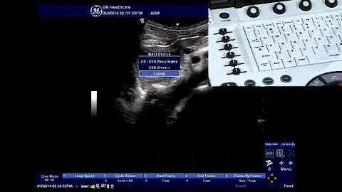 NextGen LOGIQ e: Eject USB Drive