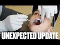 UNEXPECTED BRACES UPDATE AT THE ORTHODONTIST | NEW BRACES SURPRISE AT ROUTINE CHECKUP | FIRST BRACES