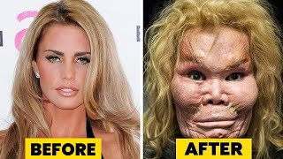 10 Celebrity Plastic Surgery Disasters