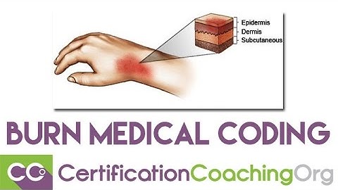 Burn Medical Coding and the Rule of Nines