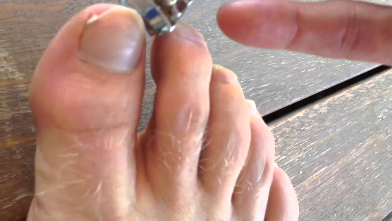 The Bi Annual cutting of the toe nails YouTube