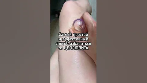 Самый простой и эффективный способ избавиться от целлюлита 🔥 #целлюлит