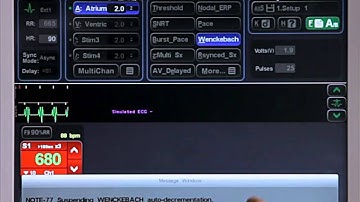 4D - Pacing Protocols - Wenckebach