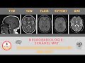 Schädel-MRT: Die wichtigsten Sequenzen für den Kopf