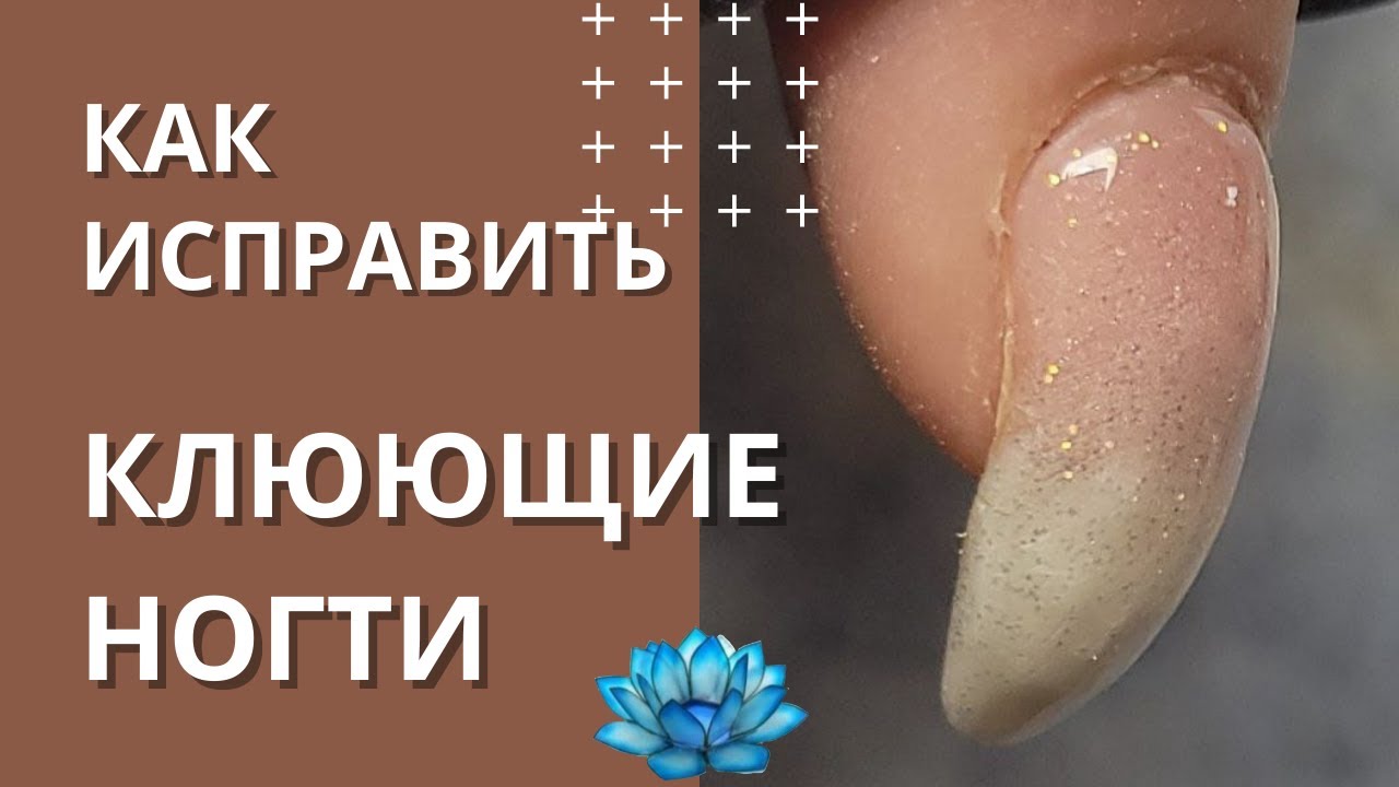 Клюющие ногти. Коррекция нарощенных ногтей.