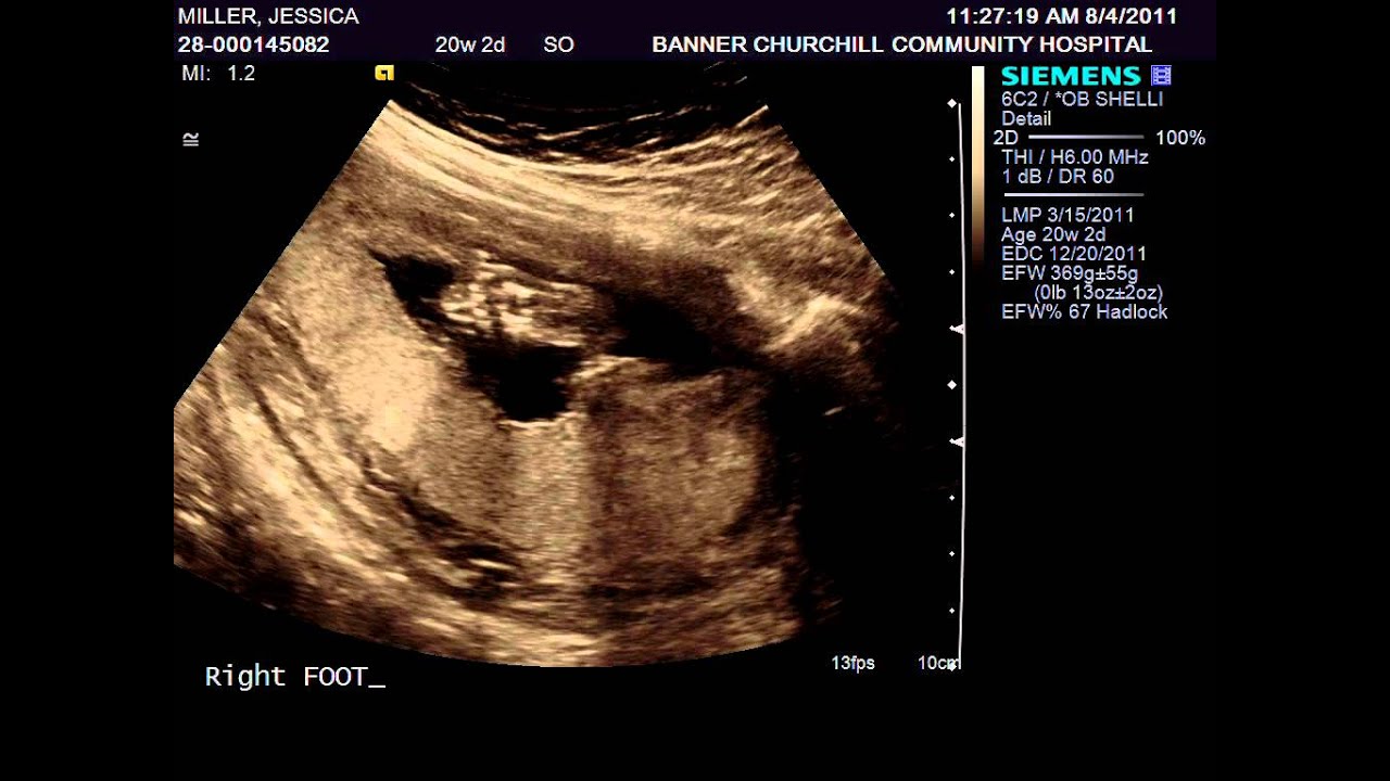 Baby Miller Feet Youtube