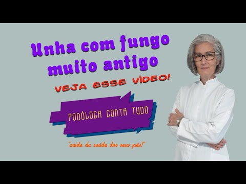 UNHA COM FUNGO MUITO ANTIGO: VEJA COMO CUIDAR EM CASA!